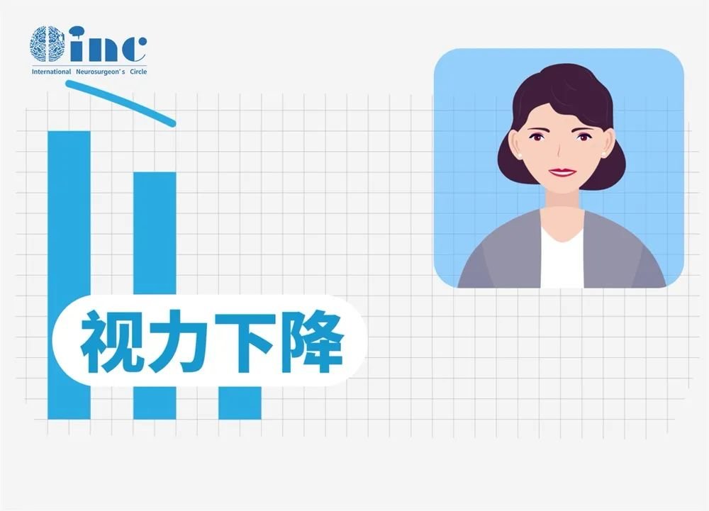眼前一黑，視力下降……揭秘神經(jīng)外科的“視力竊賊”——垂體瘤