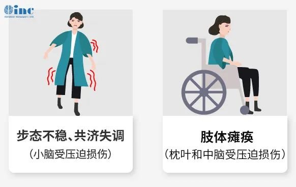 癥狀