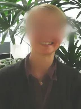 圖：患者功能均很好，無(wú)面癱、肢體癱瘓等，工作和生活如常
