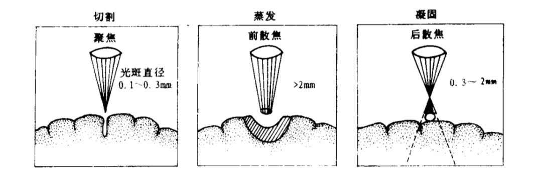 激光對腦組織的熱效應