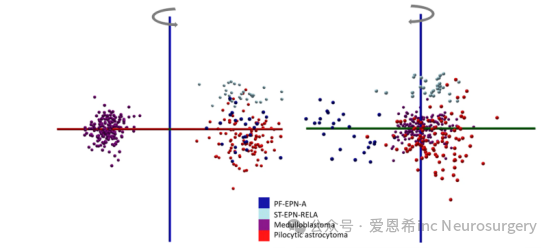 圖2. 基于表1中18種已鑒定代謝物的稀疏PCA-LDA模型。該模型采用稀疏(或低復(fù)雜度)的PCA-LDA建模方法(使用AMX6.18)，與圖S2中使用m/z 100?1000范圍內(nèi)所有m/z特征不同，此處僅利用表1中完全鑒定的代謝物陣列。在此，多變量模型僅基于表1中確定并報(bào)告的18種特征的分子身份進(jìn)行同步降維構(gòu)建。我們展示了模型的兩個(gè)視圖(圍繞LD3軸，藍(lán)色軸旋轉(zhuǎn))。LD1和LD2軸分別以紅色和綠色顯示。