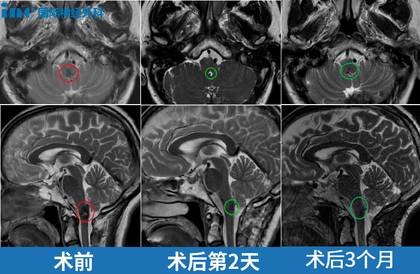 術(shù)前術(shù)后影像資料