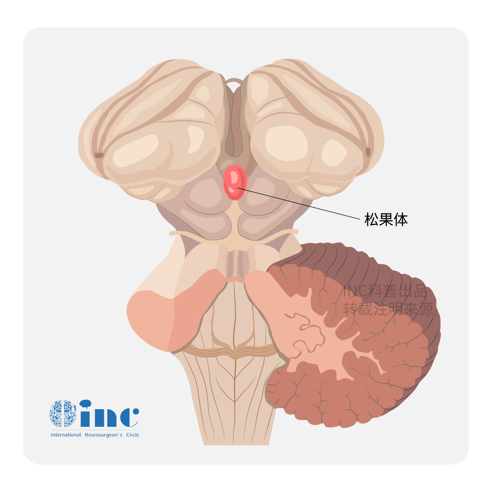 松果體區(qū)位于大腦深部顱腔中心，由松果體及其相鄰結(jié)構(gòu)組成;