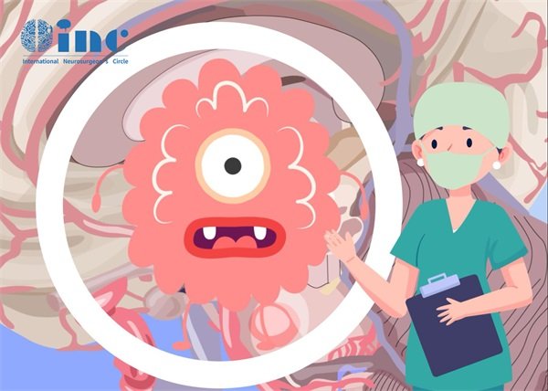 兒童腦動靜脈畸形的治療方式