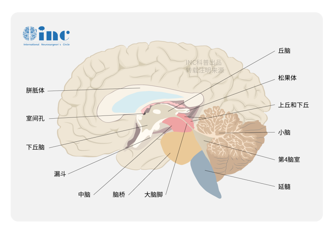 兒童以側(cè)腦室多見，成人則多見于第四腦室。少數(shù)可發(fā)生于橋腦小腦角、鞍上池、鞍區(qū)、腦干、脊髓內(nèi)。