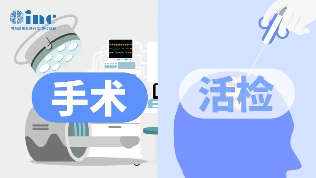 對(duì)于多數(shù)腦瘤而言，手術(shù)本身就是優(yōu)選的治療方案，通過手術(shù)就可以達(dá)到切除、明確病理診斷的雙重目的。