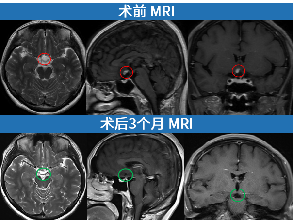 影像回顧