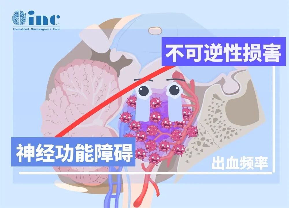 腦干病變的觀察決策需極度謹慎