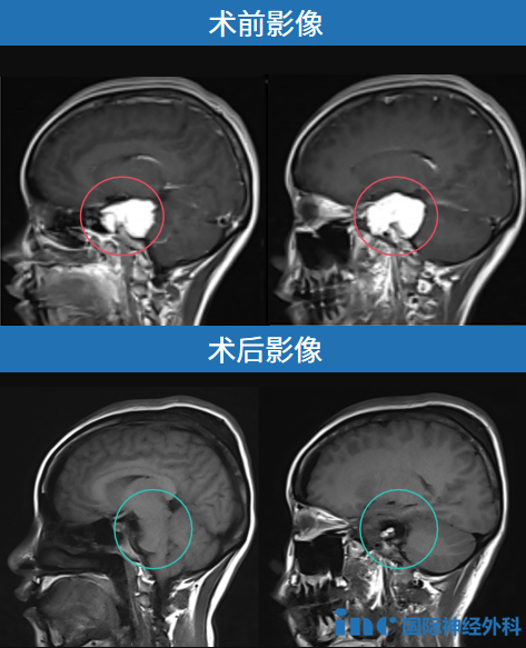 影像對(duì)比