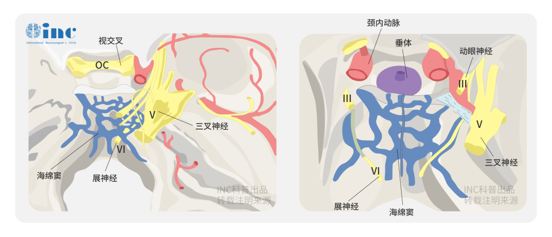 必須考慮與病變相關(guān)的關(guān)鍵神經(jīng)血管結(jié)構(gòu)的位置，包括外展神經(jīng)和三叉神經(jīng)。