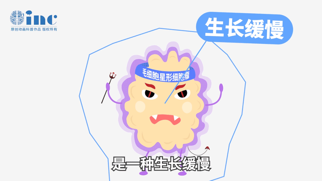 毛細胞型星形細胞瘤