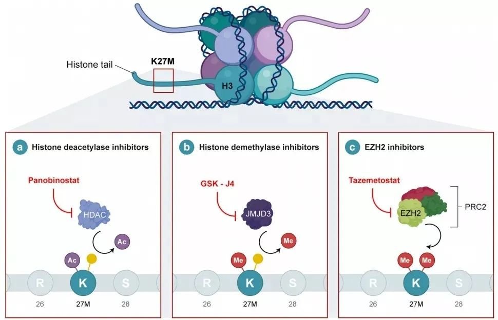 兒科 DIPG 的藥物靶點和治療。DIPG 的特征在于組蛋白 H3 中發(fā)生的 K27M 突變。