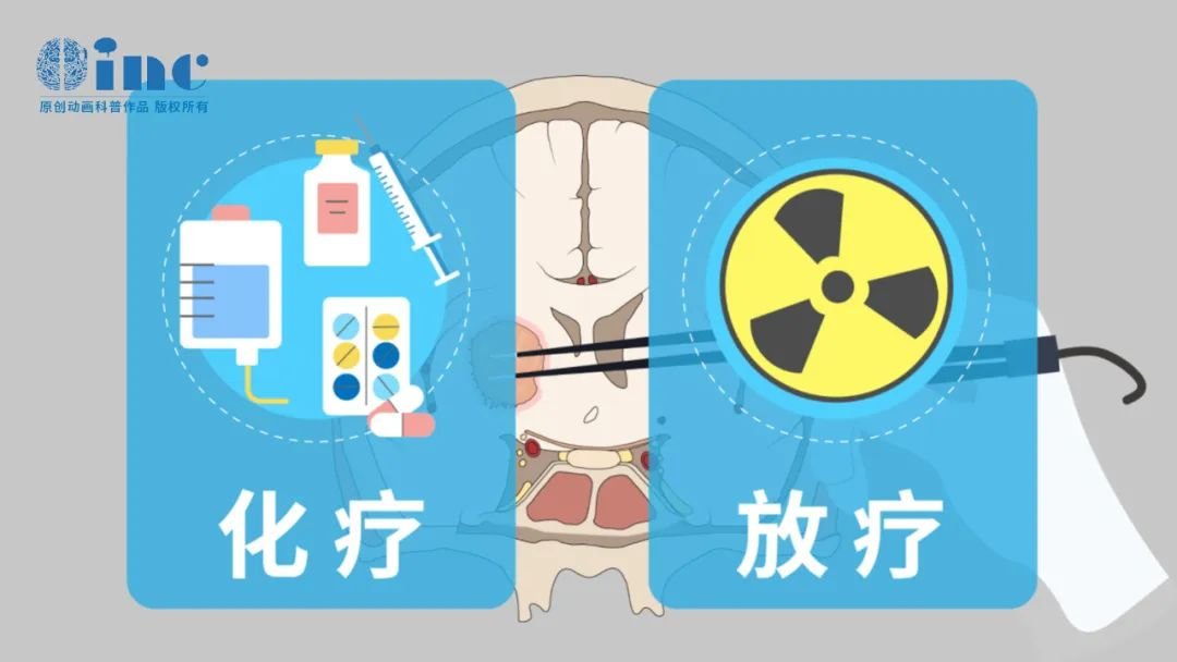 近期研究表明較早的放療對患者的總生存率無明顯影響，而接受放療時間越早，對患兒認知、生長發(fā)育及生育能力的影響越大。