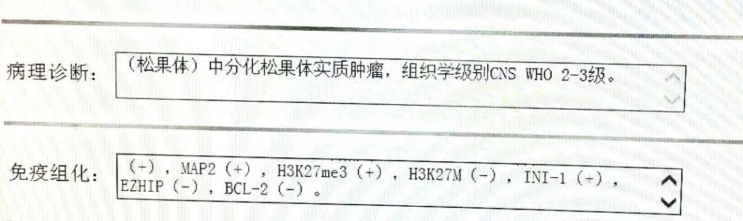 病理診斷