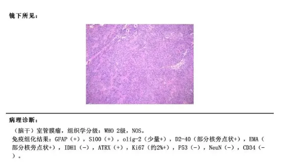 術(shù)后病理：室管膜瘤WHO 2級(jí)