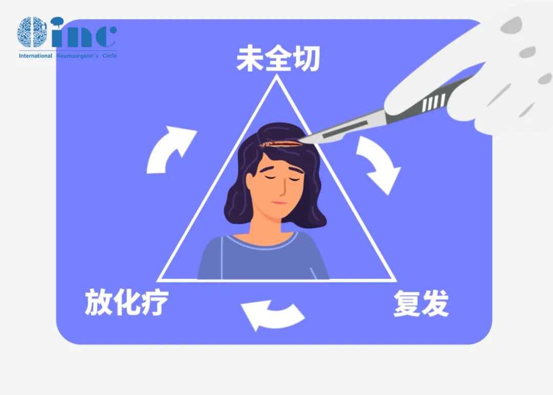 大多腦膜瘤為良性