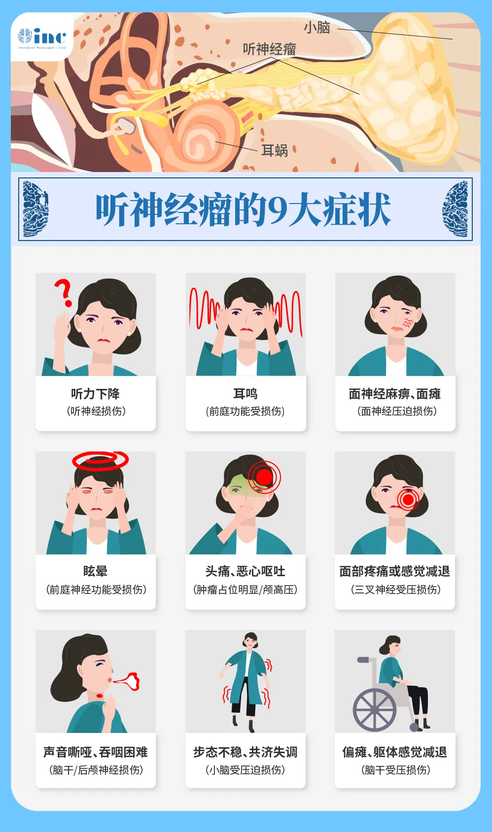 聽神經(jīng)瘤9大癥狀