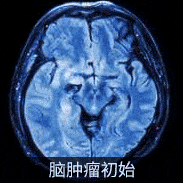 永不停歇的生存欲望，正是腫瘤可怕的力量