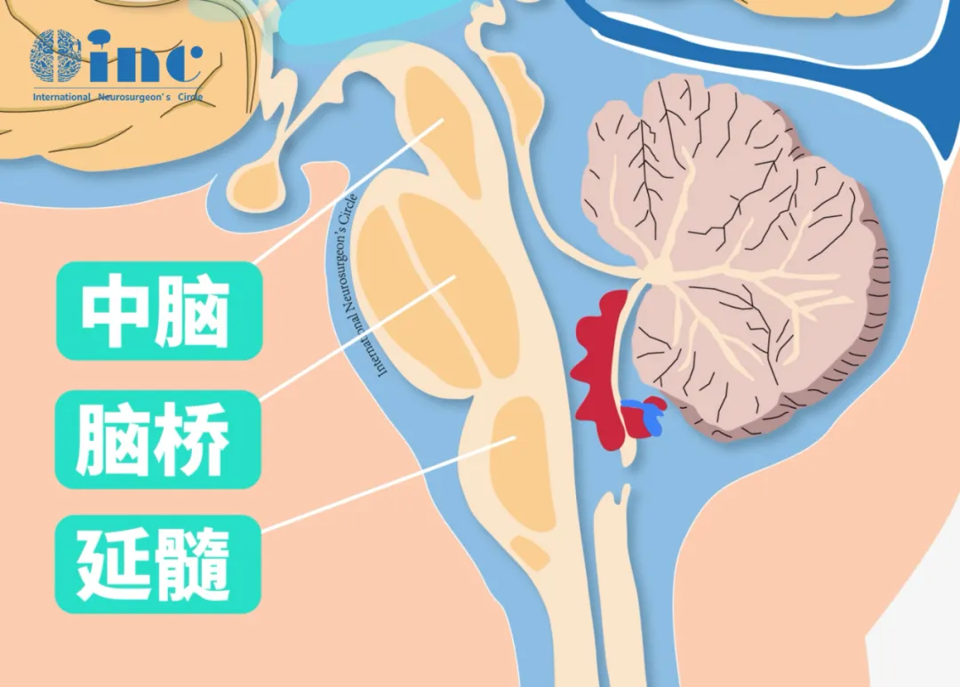 中腦位置示意